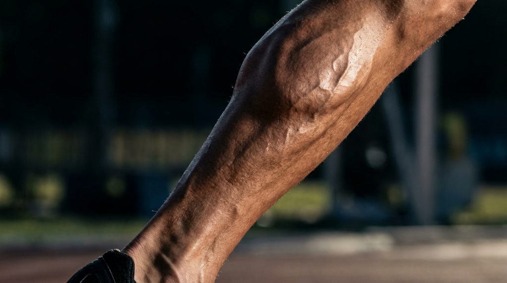 découvrez les causes fréquentes des mollets douloureux et les solutions efficaces pour soulager cette douleur et retrouver votre confort au quotidien.